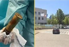 WWI Bomb in Elderly Man’s Body