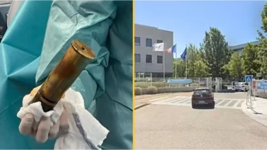 WWI Bomb in Elderly Man’s Body