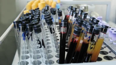 Blood collection.