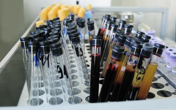 Blood collection.