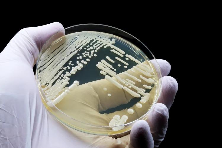 A microbiological culture of the yeast Candida auris A microbiological culture of the yeast Candida auris