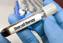 Blood sample for cell therapy.