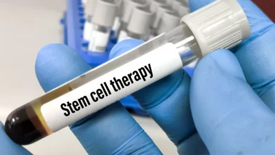 Blood sample for cell therapy.