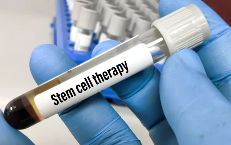 Blood sample for cell therapy.