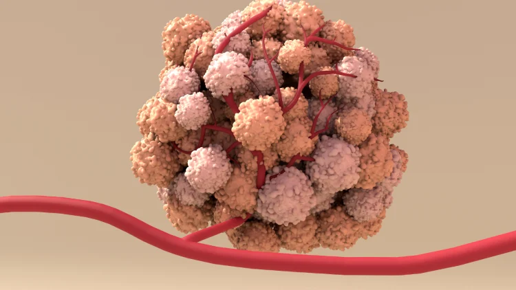 3d illustration of a Tumor 3d illustration of a Tumor.
