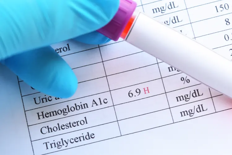 Blood sample with abnormal high HbA1c test result Blood sample with abnormal high HbA1c test result